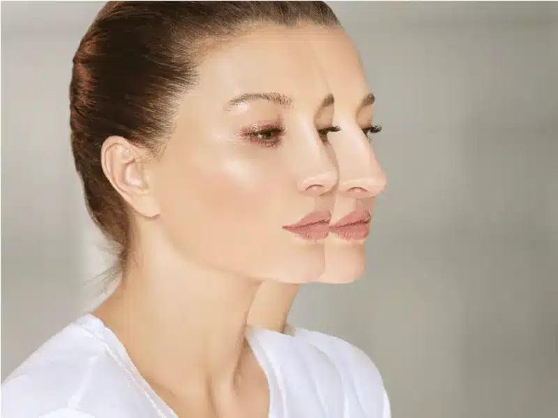 بهترین جراح بینی خانم در اصفهان