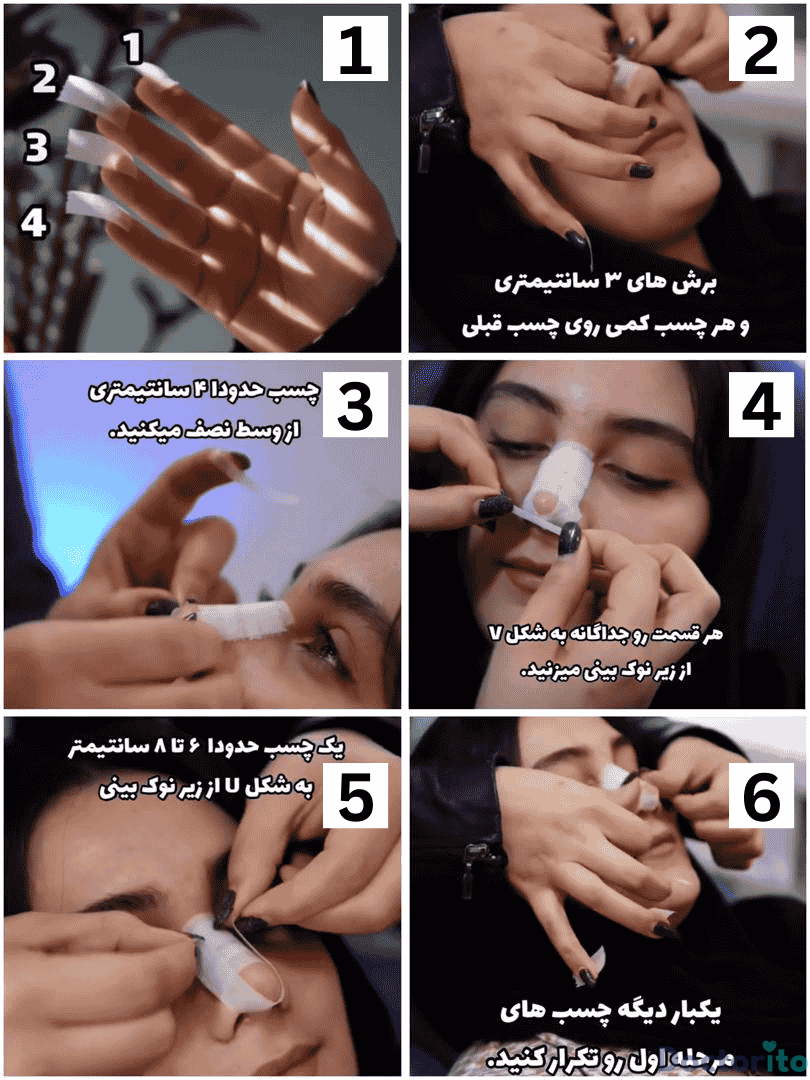 عکس نحوه چسب زدن بینی بعد از عمل