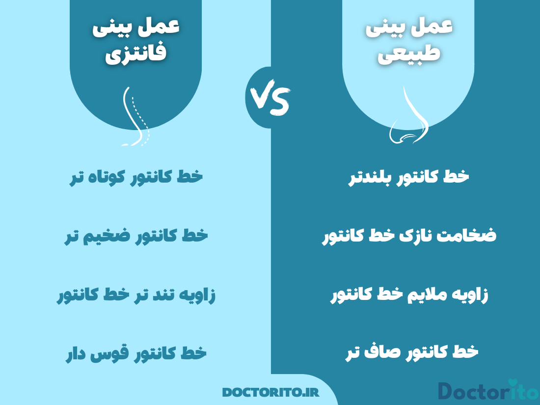تفاوت خط کانتور در عمل بینی طبیعی و فانتزی
