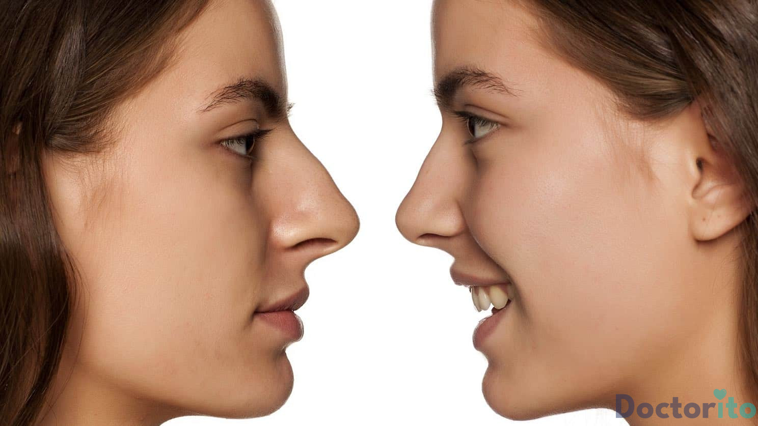 روش های عمل بینی استخوانی 
