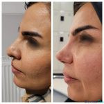 نمونه کار دکتر شمیلا رضوانی نیا (1)