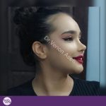 نمونه عمل بینی دکتر ونون آصفی 1