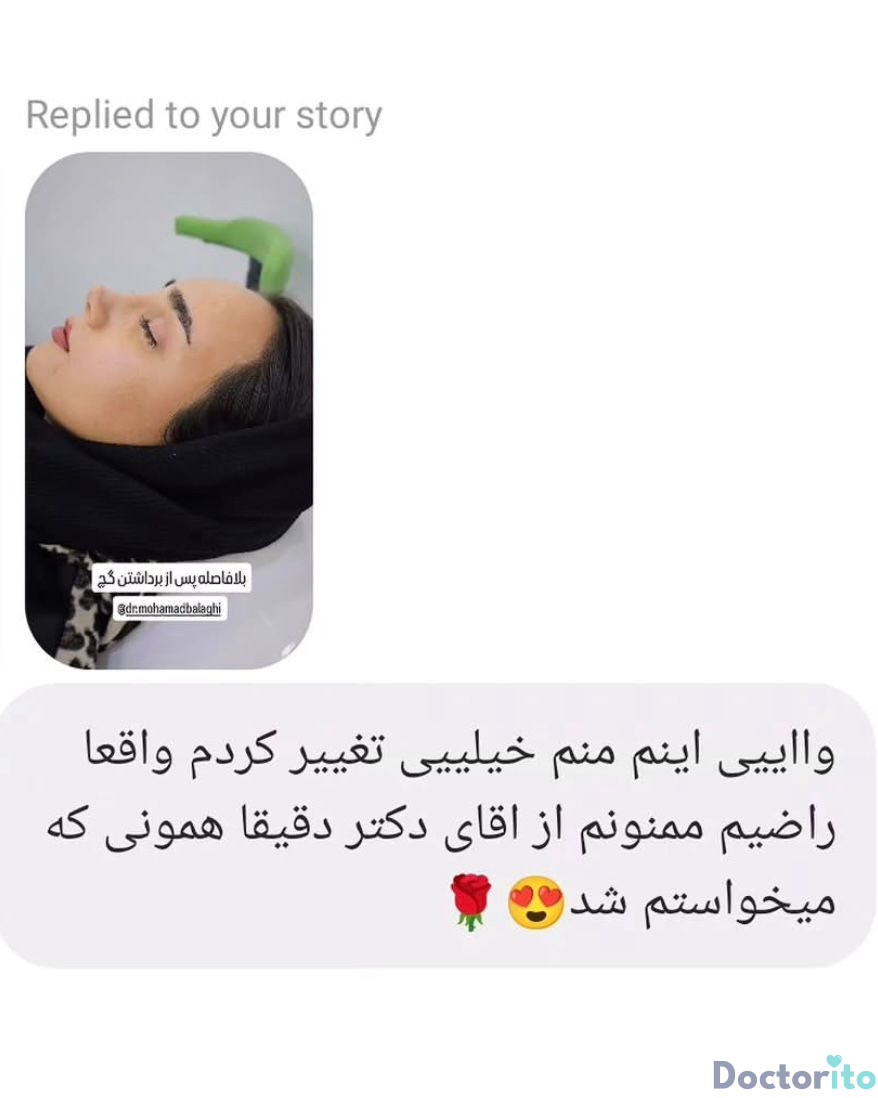 نظرات در مورد دکتر محمد بلاغی جراح بینی شیراز (1)