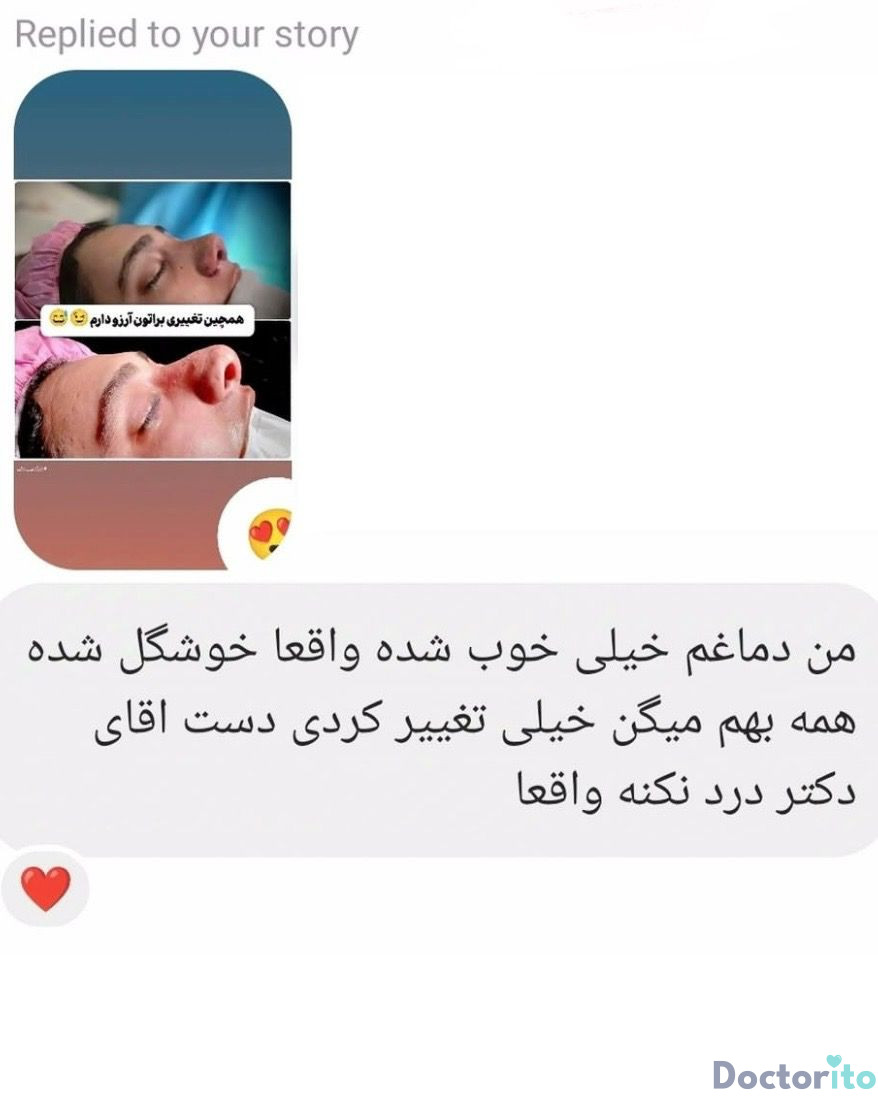 نظرات در مورد دکتر محمد بلاغی جراح بینی شیراز (2)