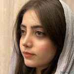 نمونه جراحی بینی دکتر بهنام خرمی (3)