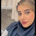 نمونه جراحی بینی دکتر حنیف اخوت (5)