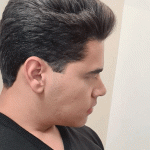 نمونه جراحی بینی دکتر مهدی قدیری (2)