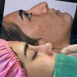 نمونه جراحی بینی دکتر نفیسه محمودی (3)