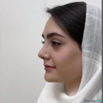 نمونه عمل بینی دکتر امین قانعی (1)