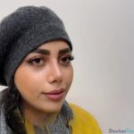نمونه عمل بینی دکتر امین قانعی (2)