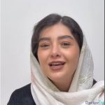 نمونه عمل بینی دکتر امین قانعی (3)