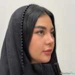 نمونه عمل بینی دکتر امین قانعی (4)
