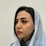 نمونه عمل بینی دکتر امین قانعی (6)