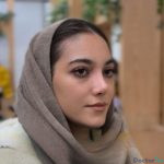 نمونه عمل بینی دکتر امین قانعی (7)