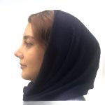 نمونه عمل بینی دکتر راستی