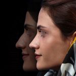 نمونه عمل بینی دکتر علیرضا مجلسی 4
