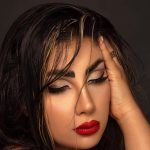 نمونه عمل بینی دکتر نجارزاده 4