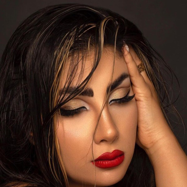 نمونه عمل بینی دکتر نجارزاده 4