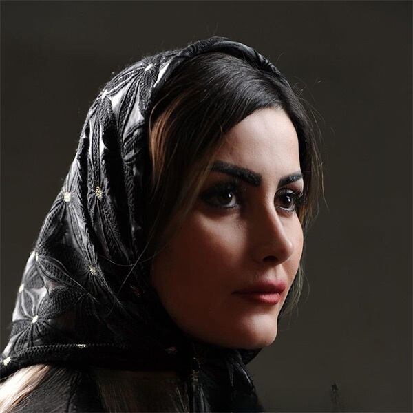نمونه عمل بینی دکتر نجارزاده 8