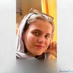 نمونه عمل بینی دکتر پورصیرفی 6