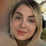 نمونه عمل بینی دکتر پورصیرفی3