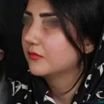 نمونه جراحی بینی دکتر جمشید سعید