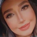 نمونه عمل بینی دکتر منصور توفیقی1