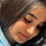 نمونه عمل بینی دکتر امید قاسم زاده 2