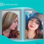 نمونه کارهای دکتر بهزاد عزیزی