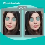 نمونه کارهای دکتر بهزاد عزیزی