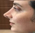 نمونه عمل دکتر پروانه روحانی رفتار