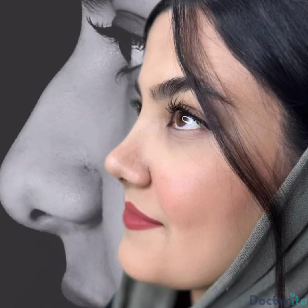 نمونه کار دکتر آمیتیس نوذری 1