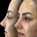 نمونه عمل دکتر پروانه روحانی رفتار1