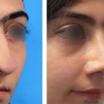 نمونه عمل دکتر علی اصغر عربی میانرودی 2