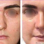 نمونه عمل دکتر علی اصغر عربی میانرودی