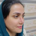 نمونه کار عمل بینی مژگان حسین رضایی1