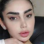 نمونه عمل دکتر علی خدارحمی3