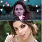 نمونه کار جراحی بینی دکتر اصحاب یمین 3