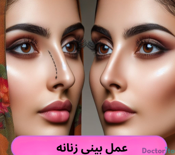 جراحی بینی زنانه