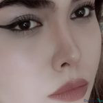  نمونه عمل دکتر علی دماوندی2