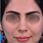  نمونه عمل دکتر علی دماوندی