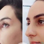 نمونه کار عمل دکتر حسین شاکری