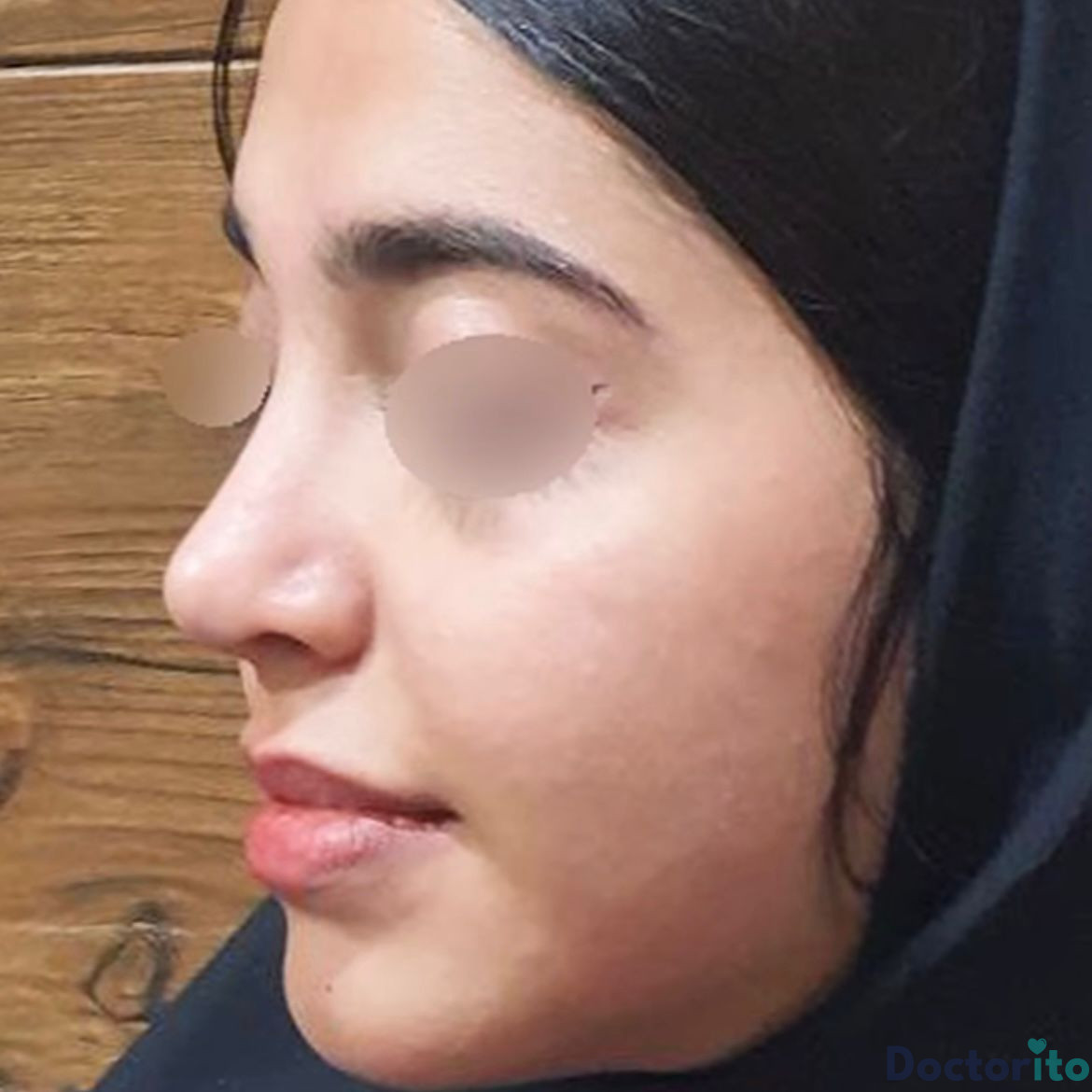 نمونه عمل دکتر رضا کبودخانی (1)