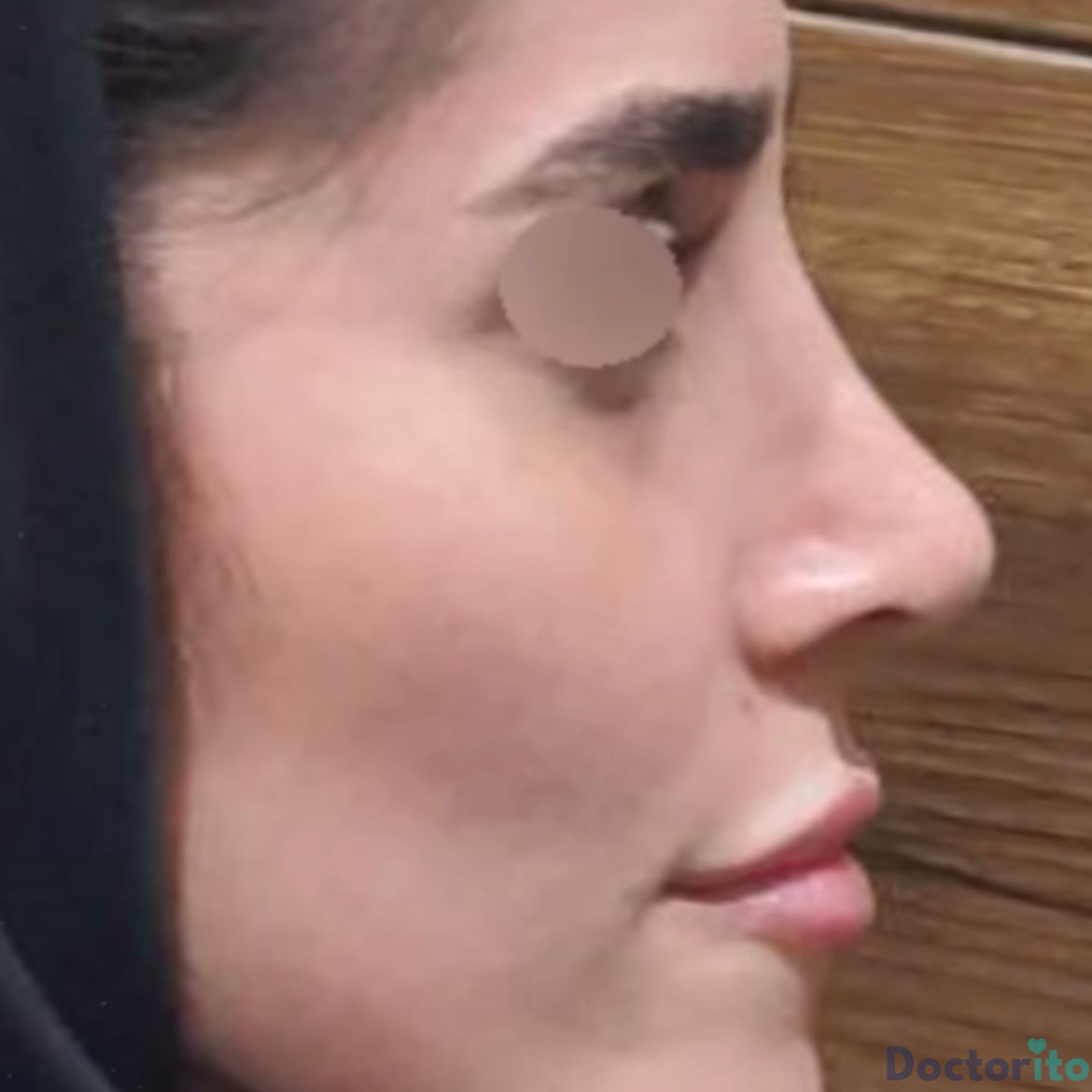 نمونه عمل دکتر رضا کبودخانی (2)