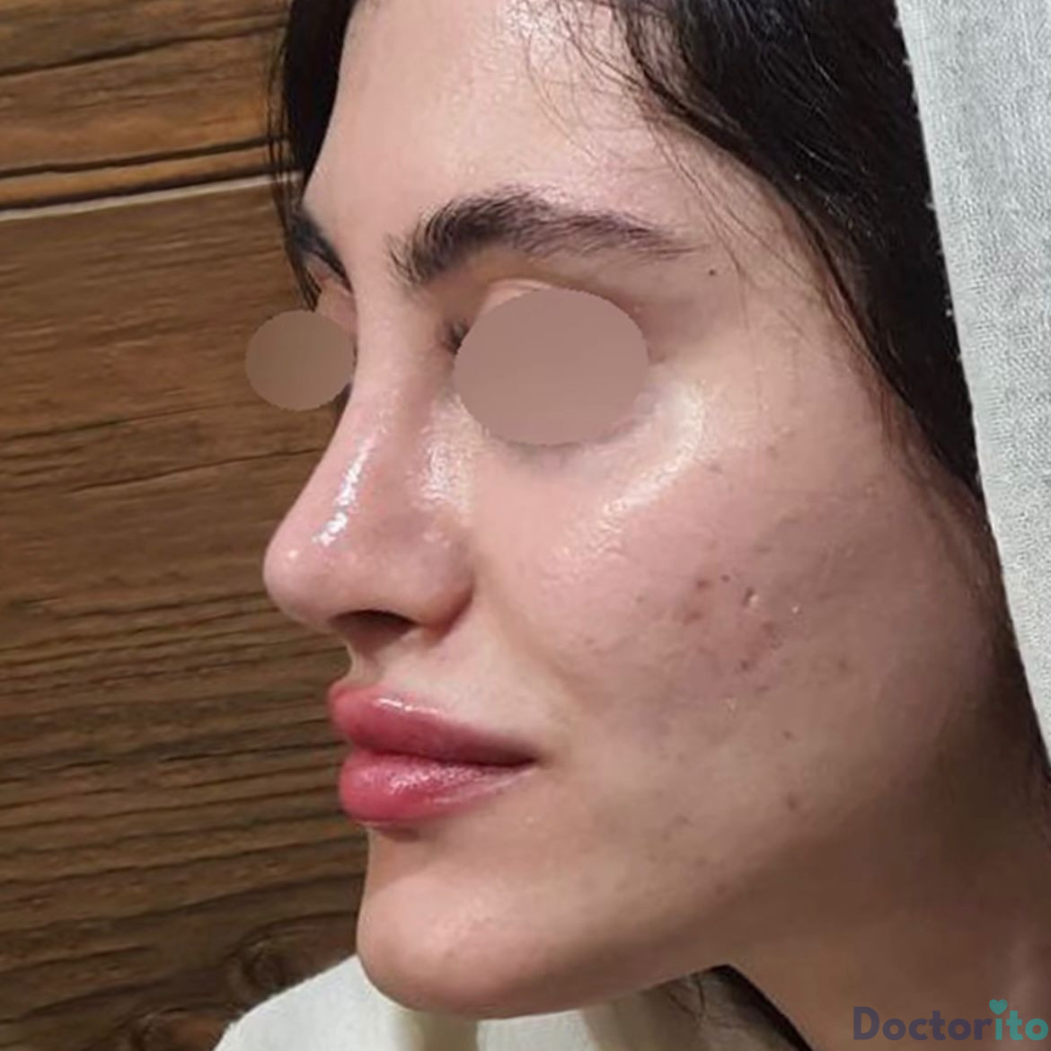 نمونه عمل دکتر رضا کبودخانی (3)