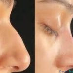 نمونه عمل دکتر جمشید اسماعیل زاده1