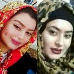 نمونه کار جراحی بینی دکتر اصحاب یمین (2)