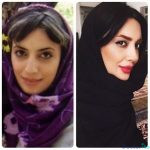 نمونه کار جراحی بینی دکتر اصحاب یمین 1