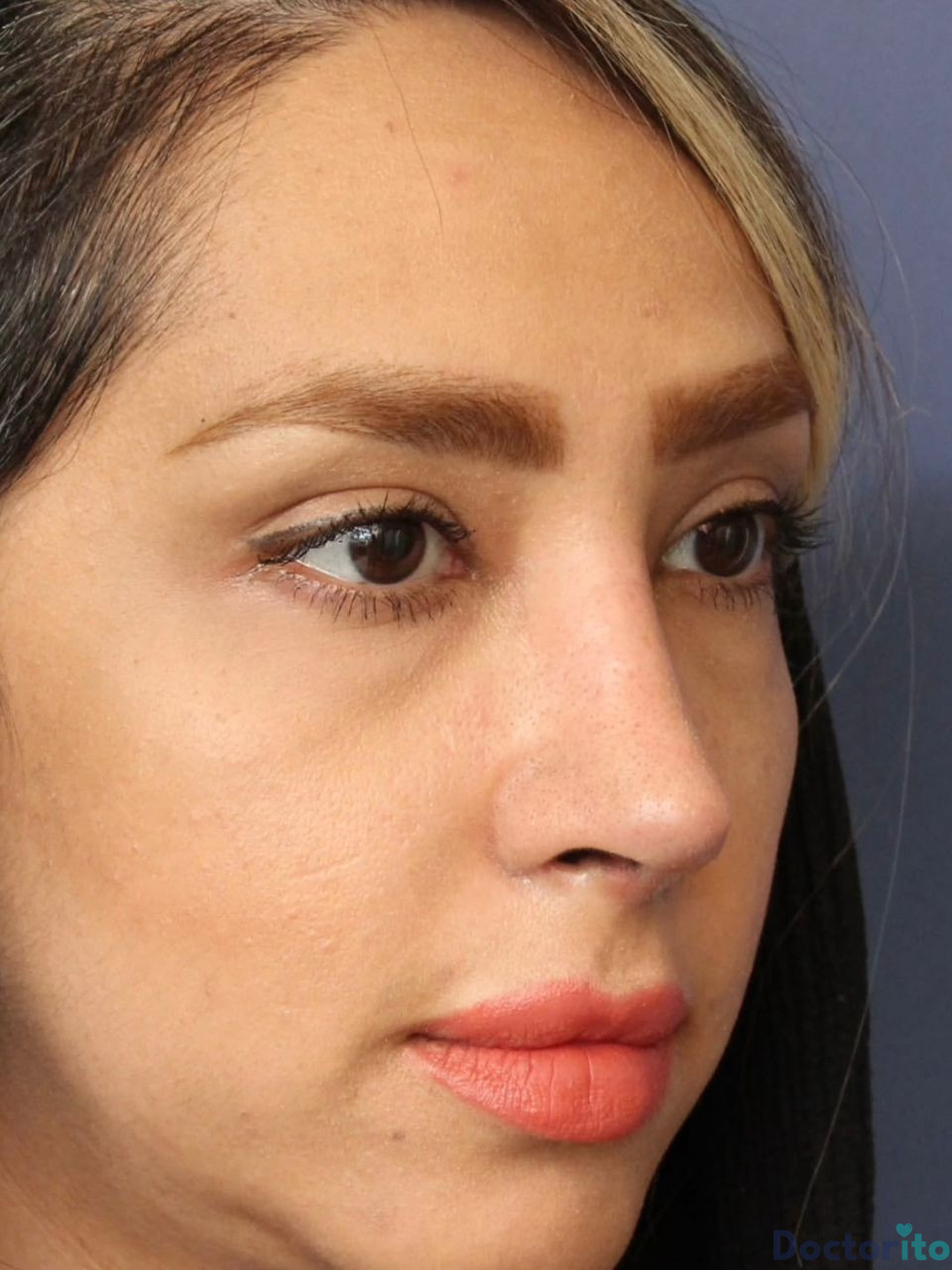 نمونه کار دکتر حسام جهاندیده (2)