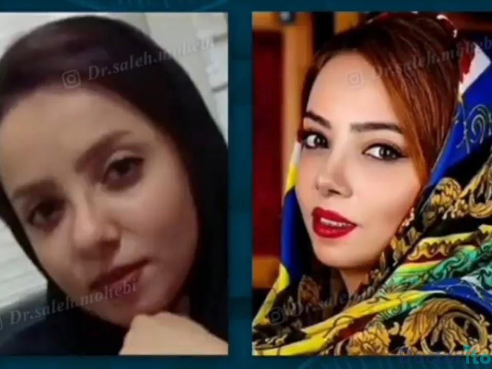 نمونه کار دکتر صالح محبی (3)